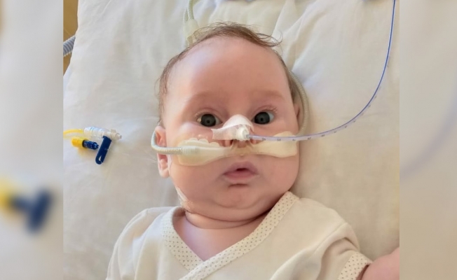 SMA hastası Yağız bebek yardım bekliyor